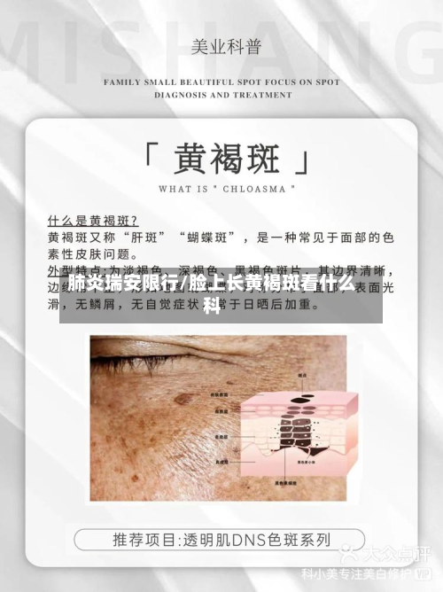 肺炎瑞安限行/脸上长黄褐斑看什么科-第2张图片