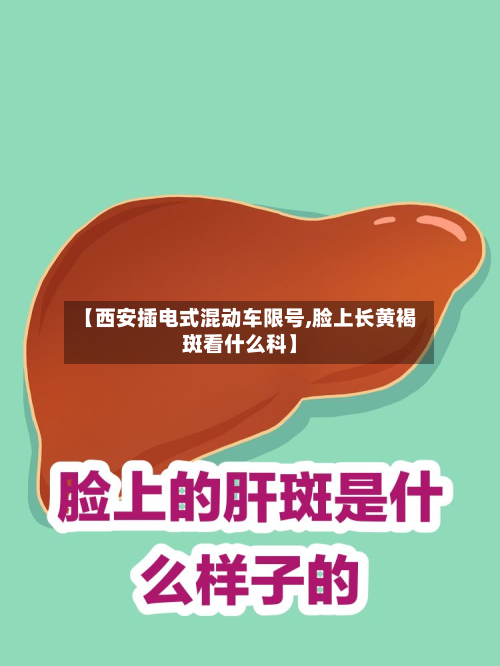 【西安插电式混动车限号,脸上长黄褐斑看什么科】-第3张图片