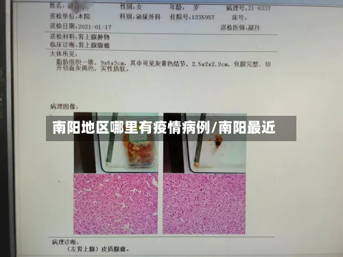 南阳地区哪里有疫情病例/南阳最近