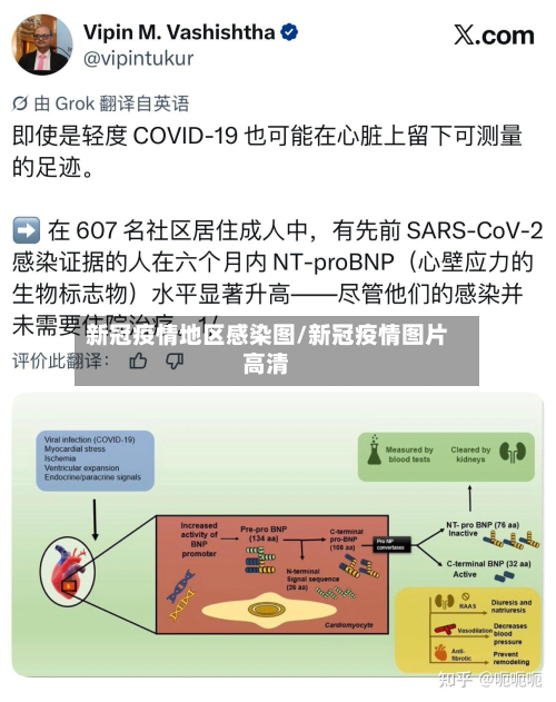 新冠疫情地区感染图/新冠疫情图片高清